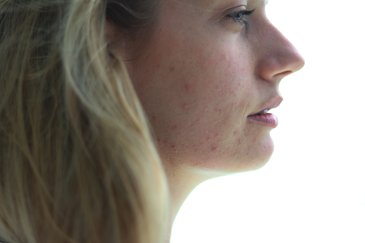 ms soho three day collagen cleanse gold masks before after